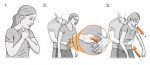 heimlich